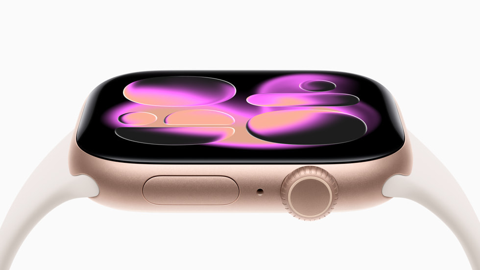Apple Watch Series 11 Produktbild